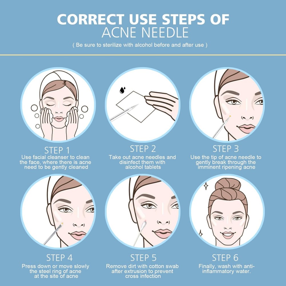 Step-by-step guide on the correct use of an acne needle with illustrations and text.