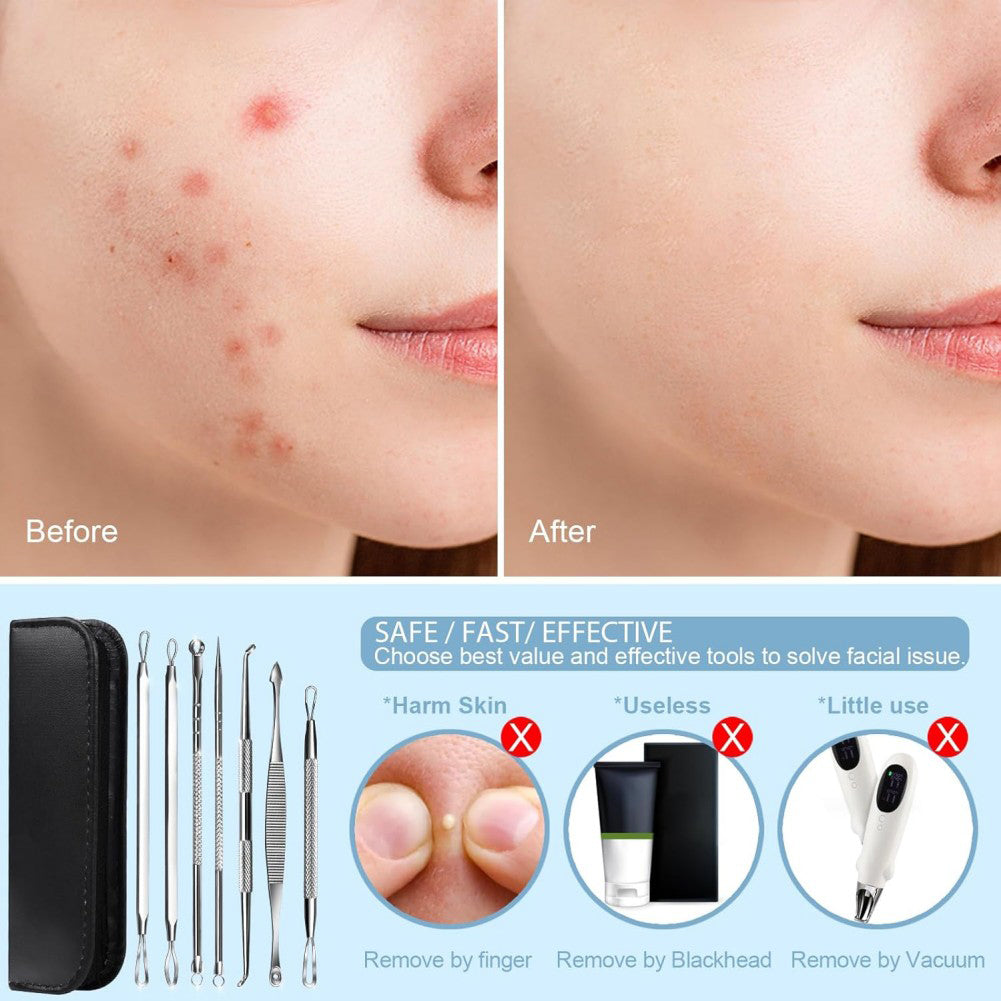 Before and after comparison of acne treatment with a set of skincare tools.