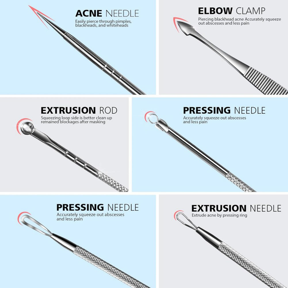 Set of acne extraction tools with labels on a light blue background